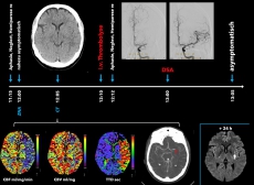 SwP E2 VaskNeu Abb2 SwP E2 VaskNeu Abb2