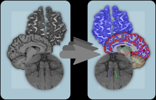 Merkmalextraktion Merkmalextraktion